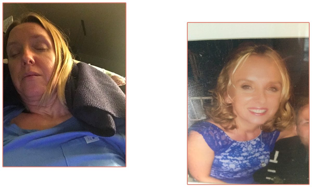 before_after1